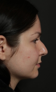 Before image, case 2